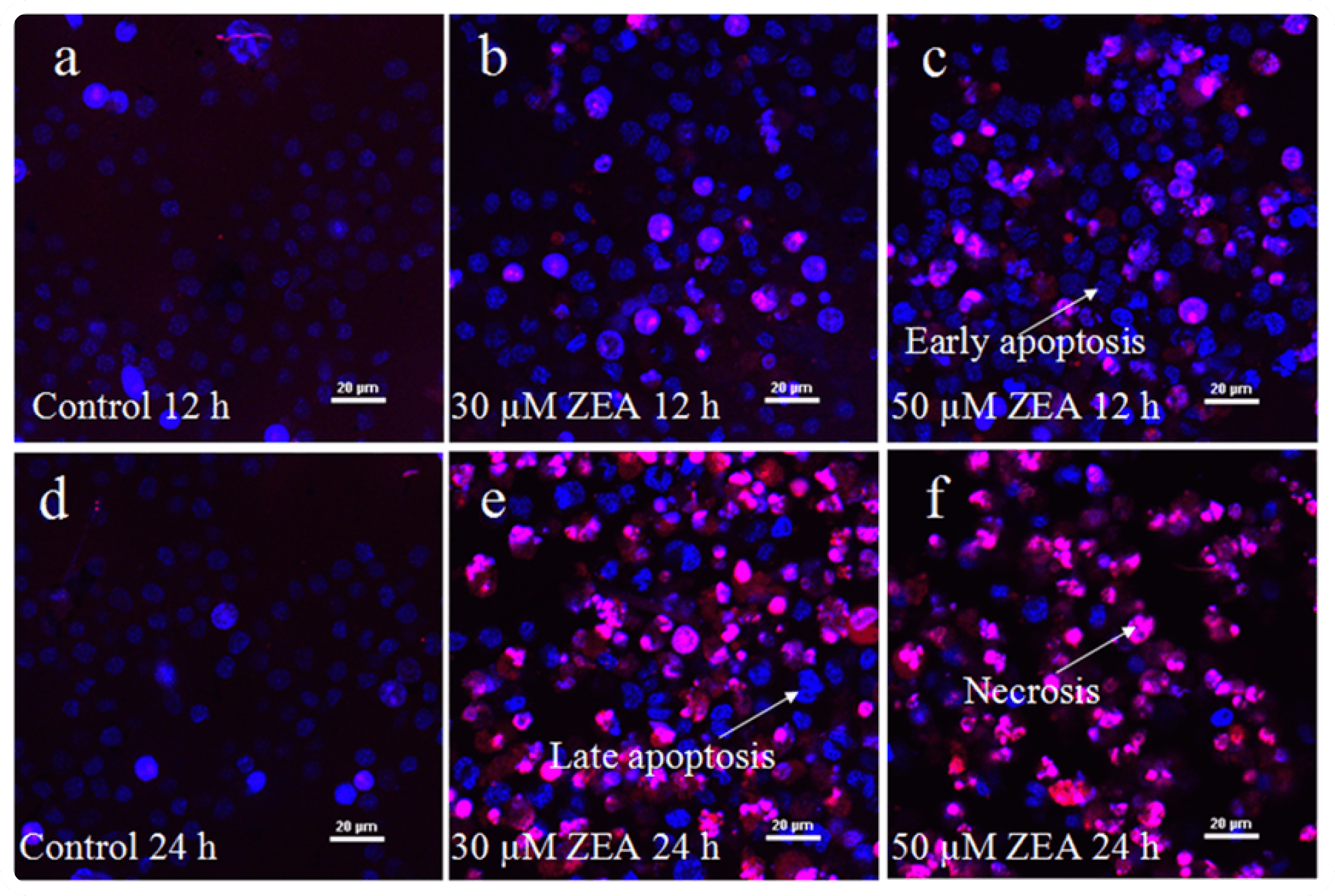 Regulated Cell Death Assays